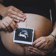 LUMC werpt met internationale databank nieuw licht op behandeling baby's met rhesusziekte